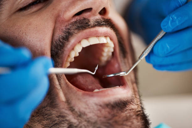 Emergency Dental Services in Cooper City, FL